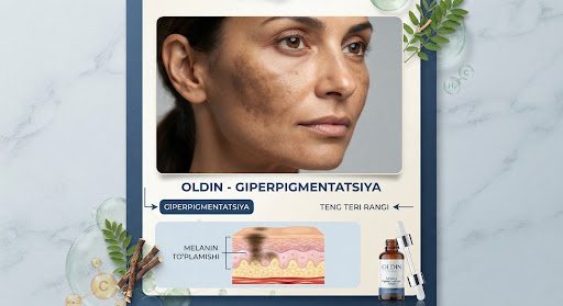 Pigmentatsiya parvarishi — oldingi surat namunasi